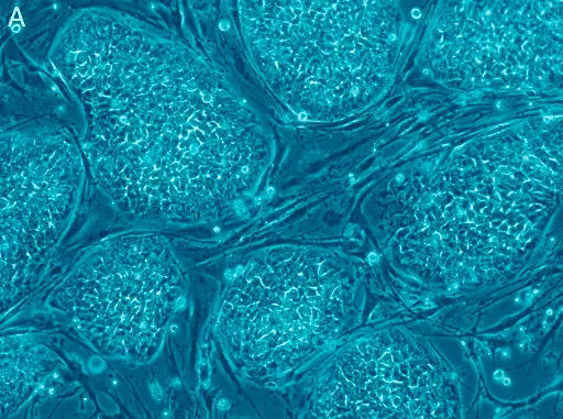 How to maximize the benefits of your Stem Cell Therapy