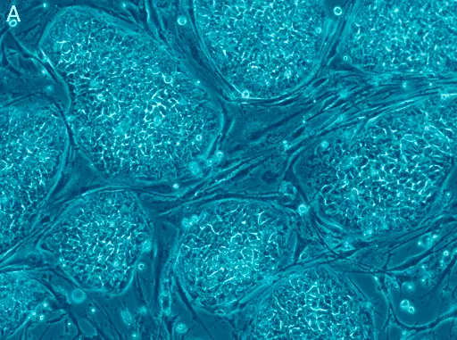 Pluripotent stem cells for regenerative medicine