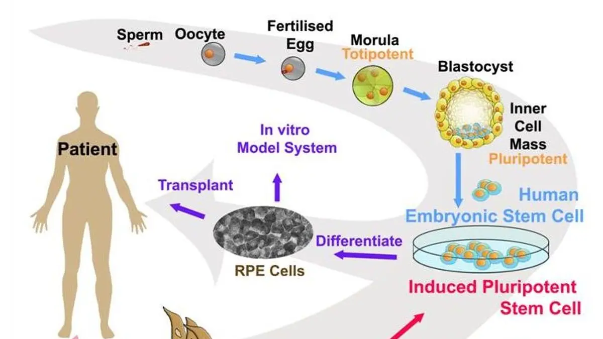 A chart detailing the potential applications of embryonic, adult, and induced pluripotent stem cells in medical treatment
