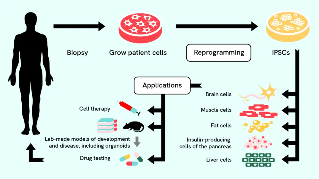 A flowchart showing the process of creating induced pluripotent stem cells from adult cells