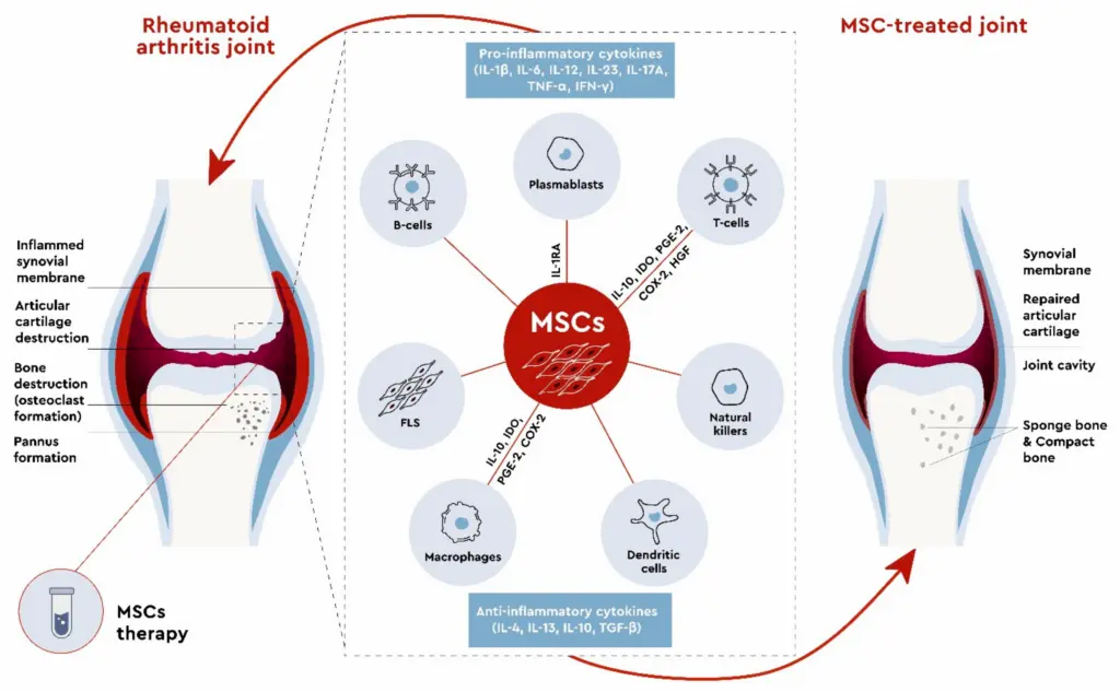 process of stem cell therapy for knee injury 
