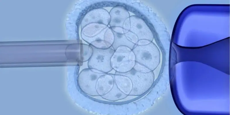 Study Finds Umbilical Cord Derived Stem Cells Effective in Cerebral Palsy Patients