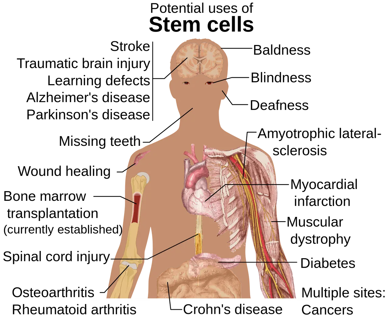 potential applications of stem cell therapy and regenerative medicine in various health conditions.