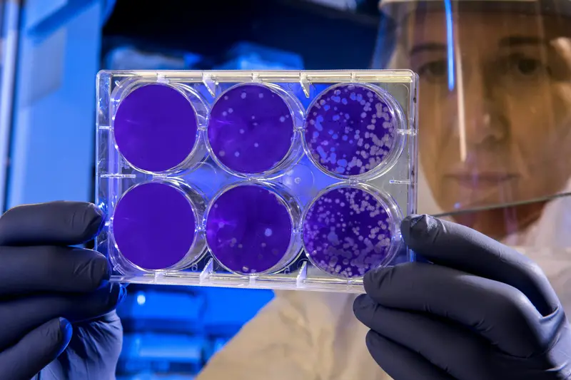 Stem Cell Therapy for Anti-Aging