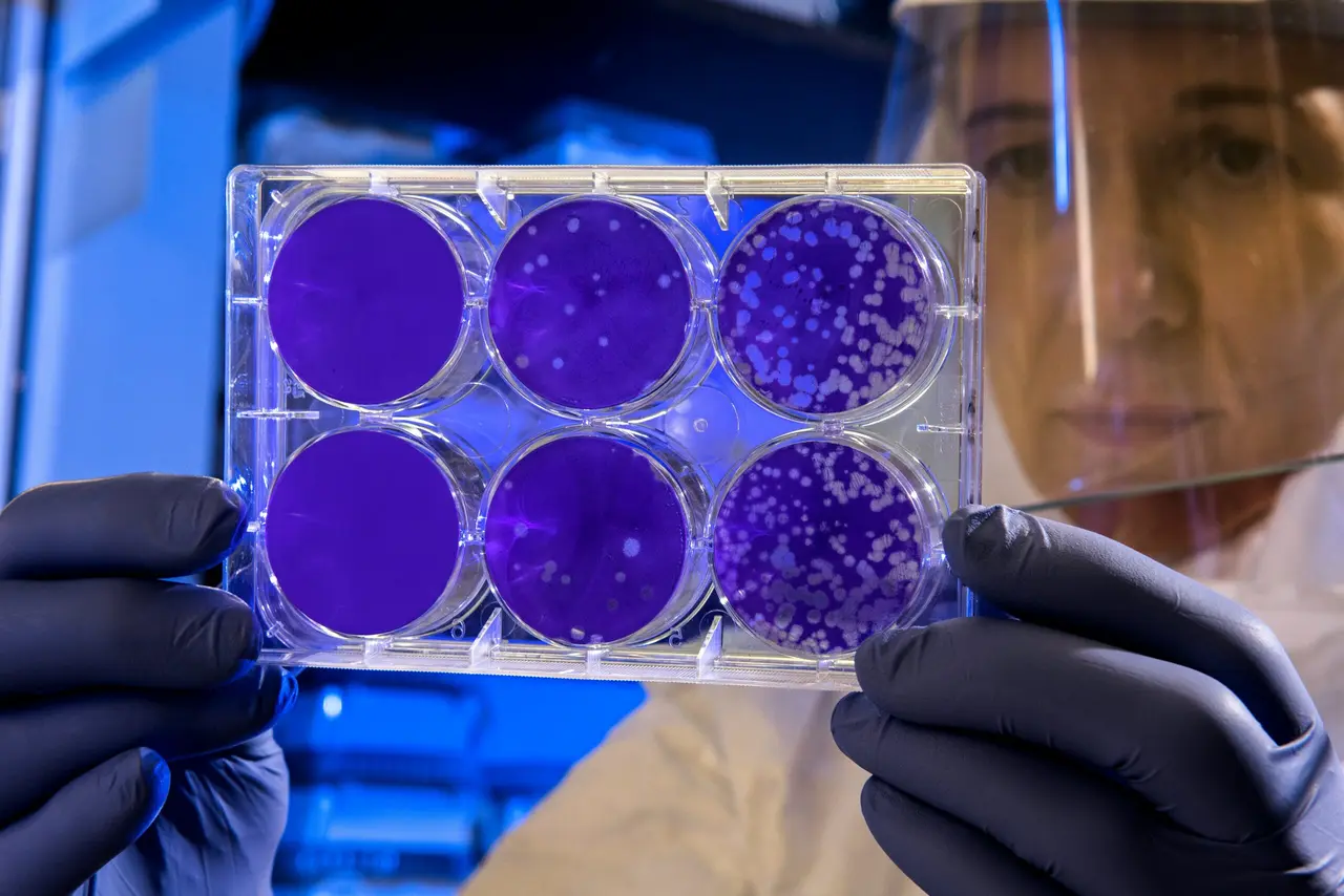 Stem Cell Therapy for Anti-Aging