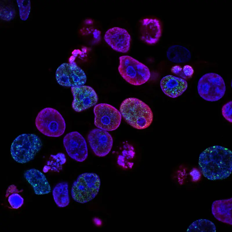 How effective is it to use a donor's stem cells?