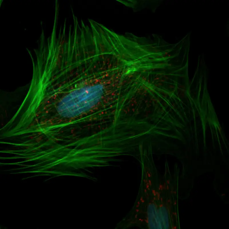 How can stem cells change my life?
