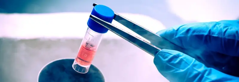 Stem Cell Therapy for Crohn’s Disease Approved in Europe