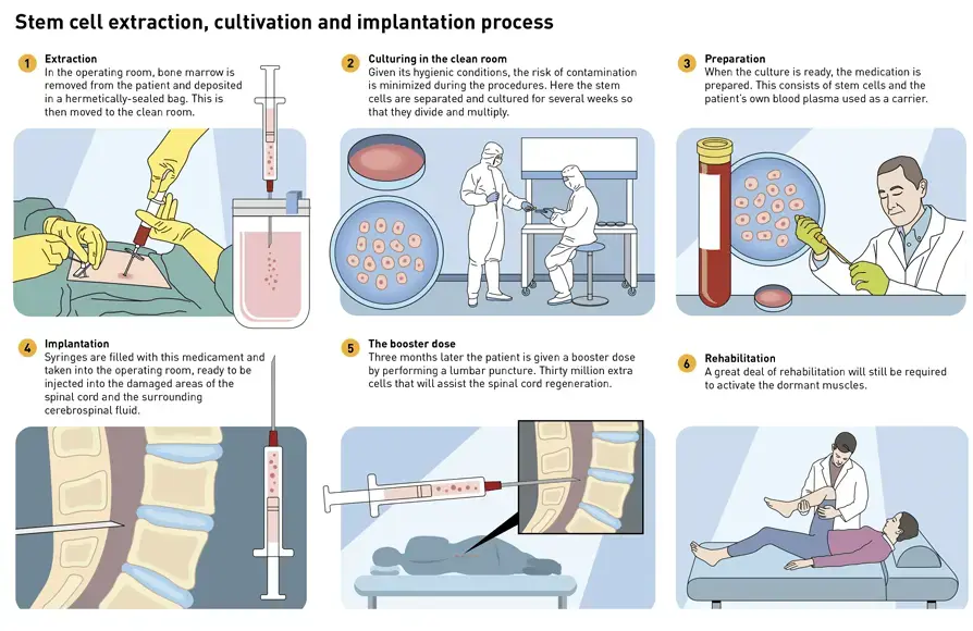 stem cell treatment process of knee injury